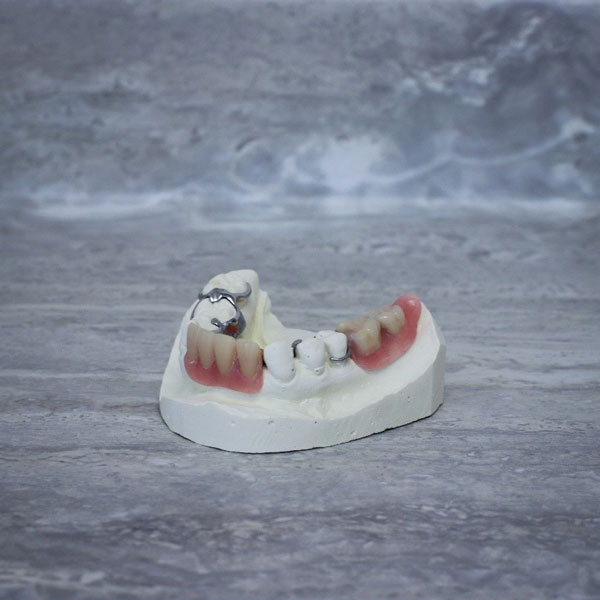 partial dentures