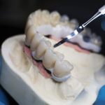 Denture FAQ: Facts, Myths, Truths & Misperceptions