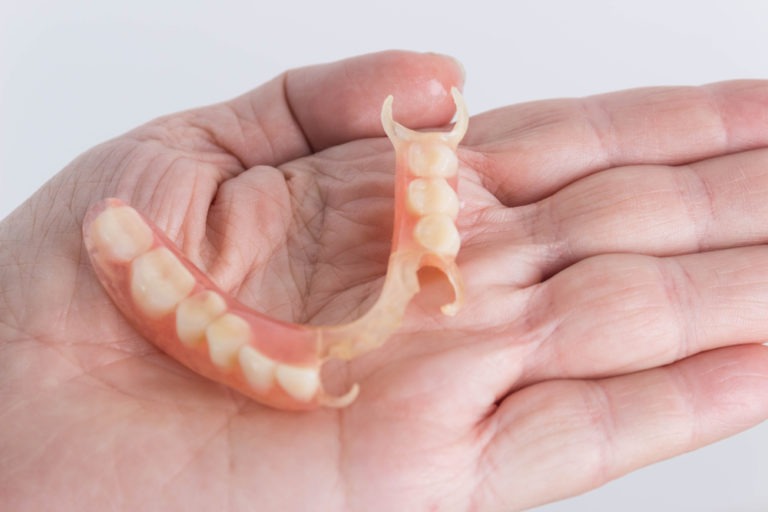 When Is It Time to Get Your Dentures Relined? Ottawa South Denture Clinic