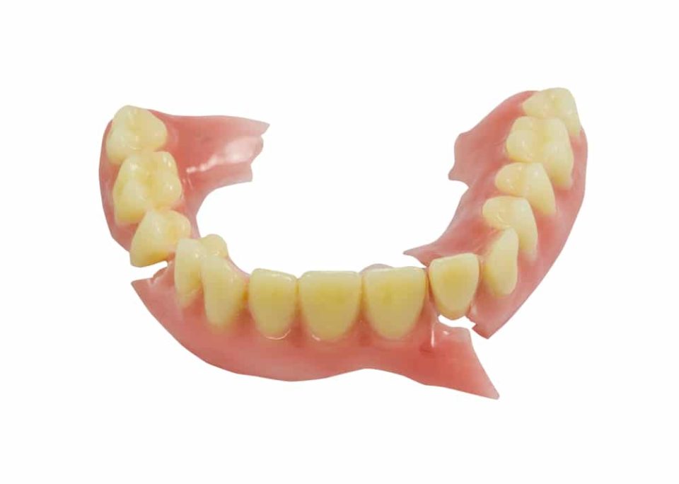 5 Advantages of Denture Repair in Ottawa | Ottawa South Denture Clinic