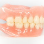 How Much Do Dentures in Ottawa Cost in 2026?