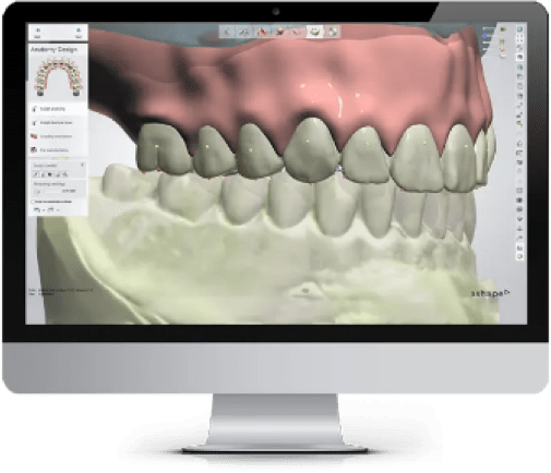 3D x-ray image of a patients teeth