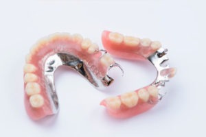 Ottawa South Denture Clinic Cast Metal Partial Dentures