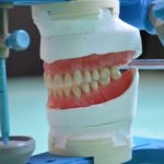 The Benefits of Custom-Made Dentures